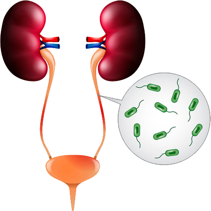 infeccionviasurinarias